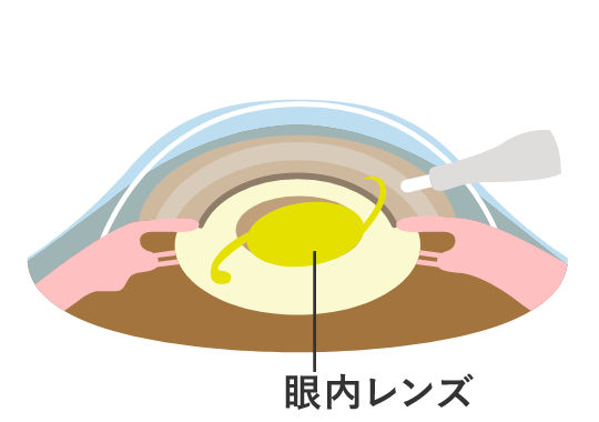 図3